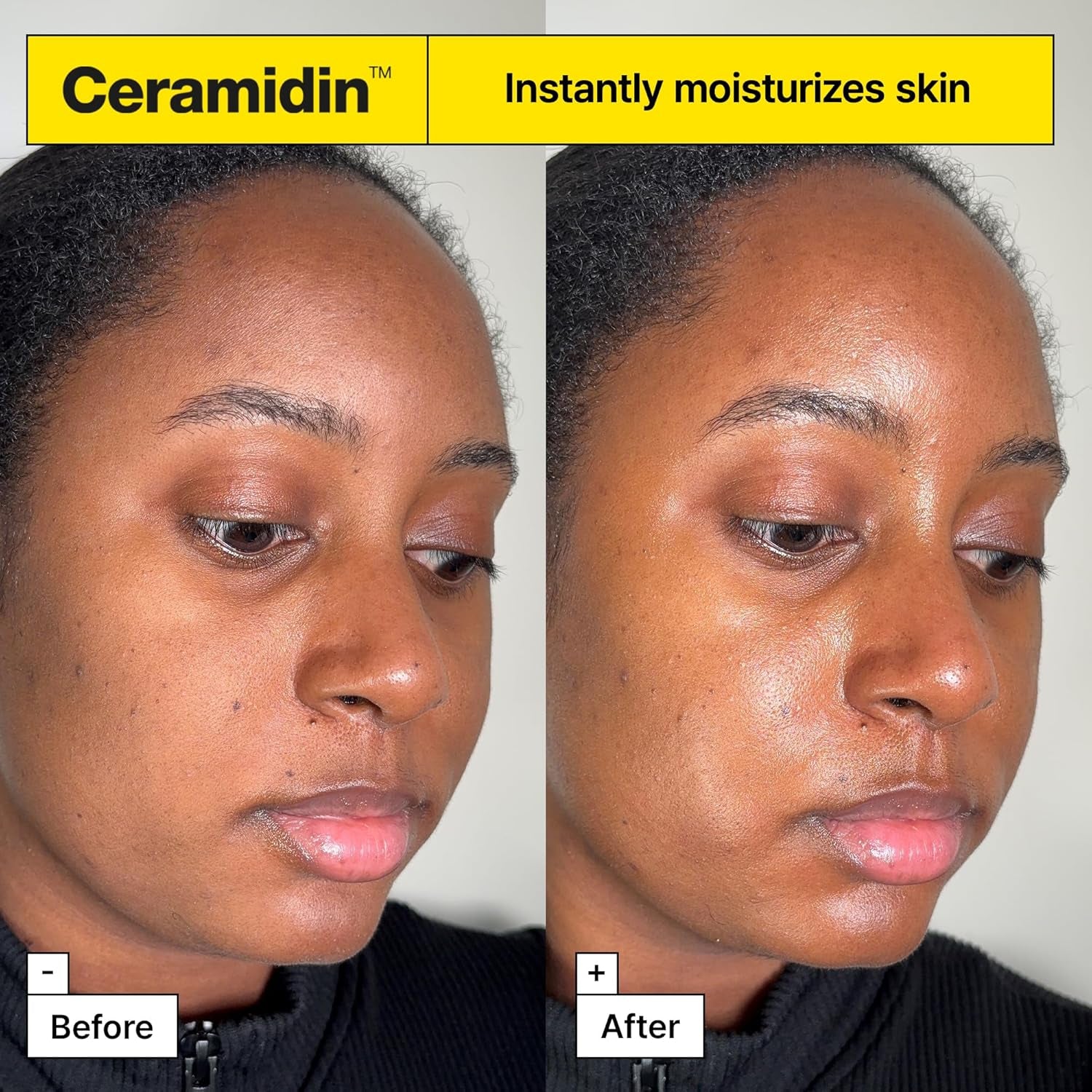 Ceramidin™ Skin Barrier Moisturizer Face Cream for Dry Skin with Ceramides and Panthenol | Korean Skin Care